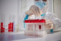 ENI|迄今最详细人类血液干细胞图谱出炉 有望为白血病提供新疗法